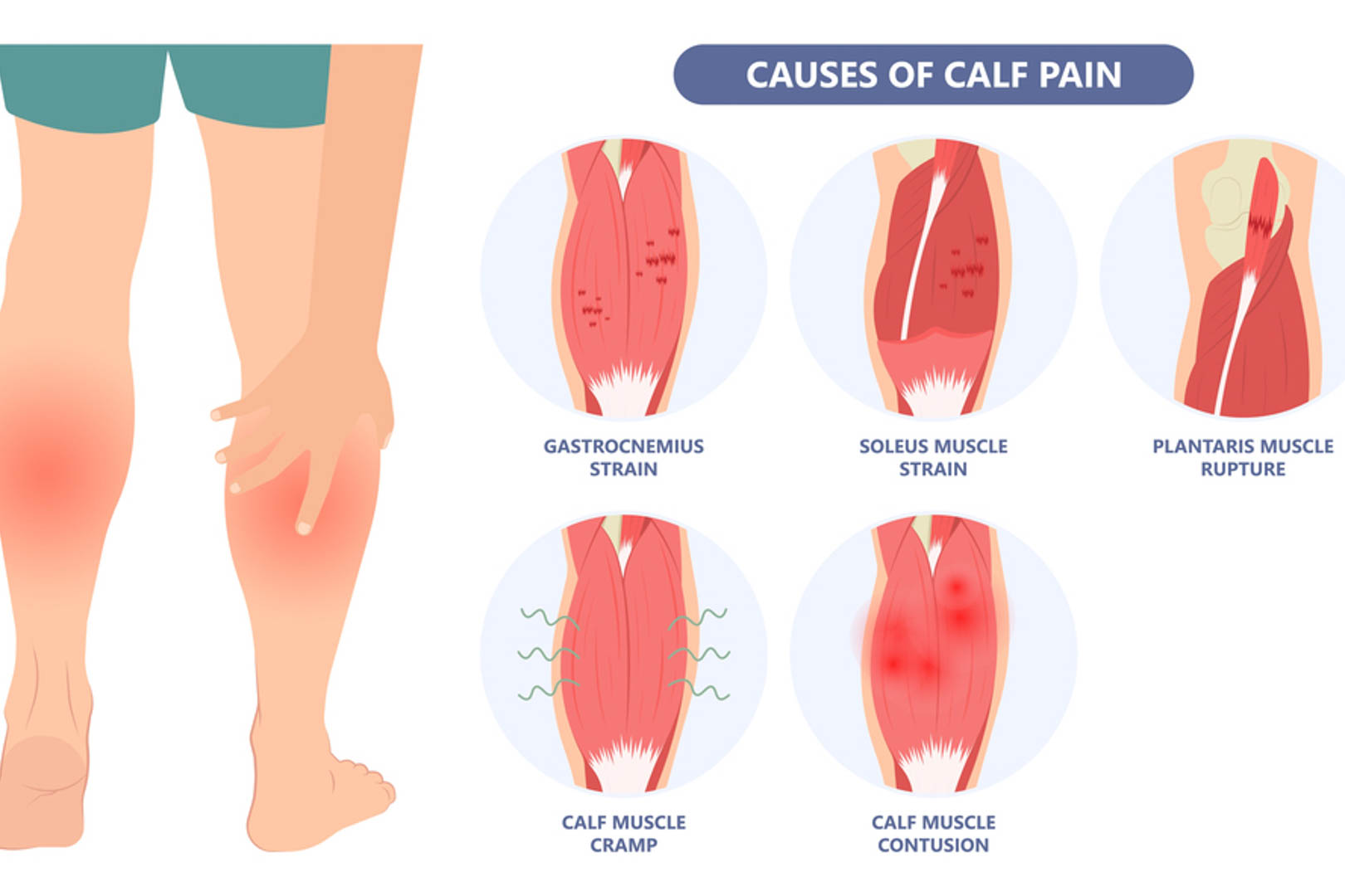 Chuột rút khi leo núi - Nguyên nhân và giải pháp